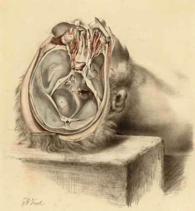 Gerahmter Druck : Knochenanatomie / Basalrand des Schädels Gerahmter Druck : Knochenanatomie / Basalrand des Schädels