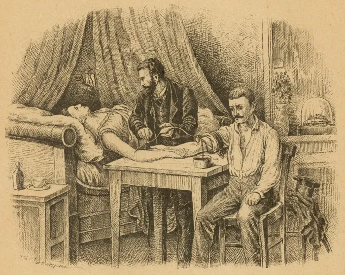 Gerahmter Druck : Bluttransfusion, 1880 Gerahmter Druck : Bluttransfusion, 1880