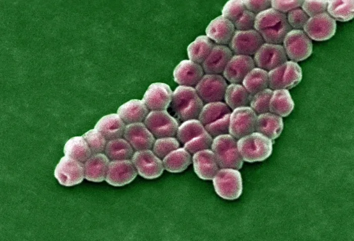 Gerahmter Druck : Acinetobacter baumannii Bakterien im SEM Gerahmter Druck : Acinetobacter baumannii Bakterien im SEM
