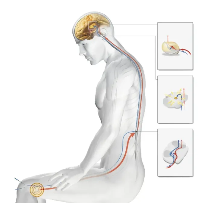 Gerahmter Druck : Acupuncture Gerahmter Druck : Acupuncture