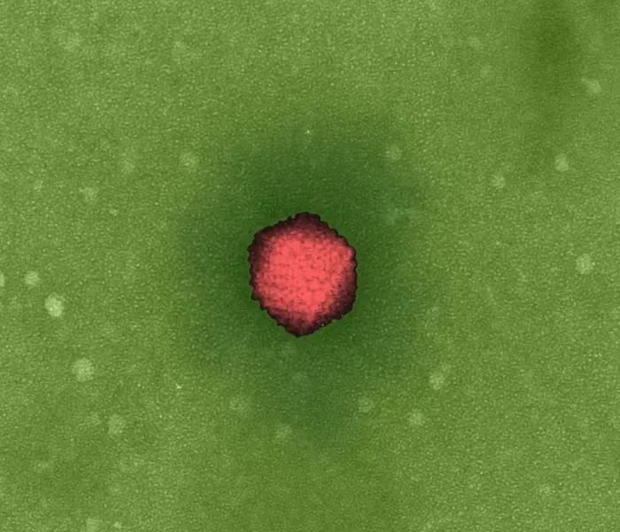 Gerahmter Druck : Adenoviruss, TEM Gerahmter Druck : Adenoviruss, TEM