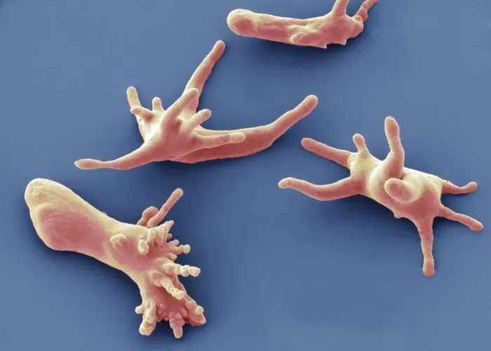Gerahmter Druck : Protozoen amoeben, SEM Gerahmter Druck : Protozoen amoeben, SEM