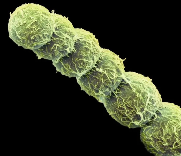 Gerahmter Druck : Anabaena-Algen, SEM Gerahmter Druck : Anabaena-Algen, SEM