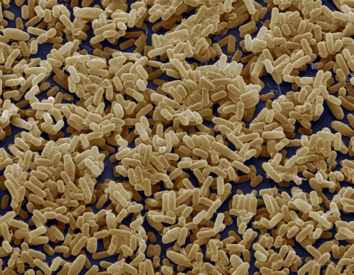 Gerahmter Druck : Bakterium Bacillus subtilis, SEM Gerahmter Druck : Bakterium Bacillus subtilis, SEM