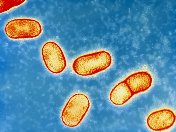 Gerahmter Druck : Zahnfleischbakterien Bifidobacteria Gerahmter Druck : Zahnfleischbakterien Bifidobacteria
