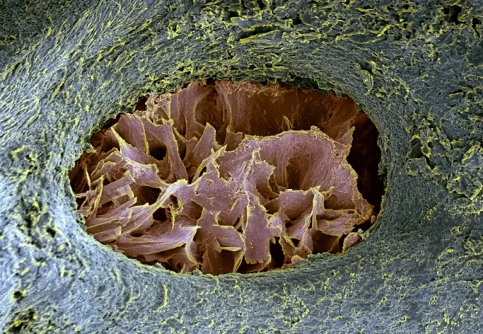 Gerahmter Druck : Knochenlacuna, SEM Gerahmter Druck : Knochenlacuna, SEM