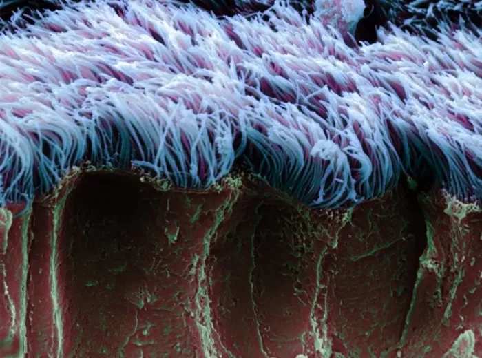 Gerahmter Druck : Bronchiale Zilien, SEM Gerahmter Druck : Bronchiale Zilien, SEM