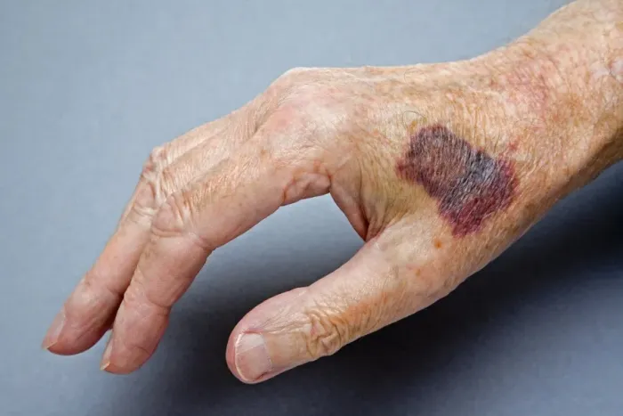 Gerahmter Druck : Schlagfertiger Hand Gerahmter Druck : Schlagfertiger Hand