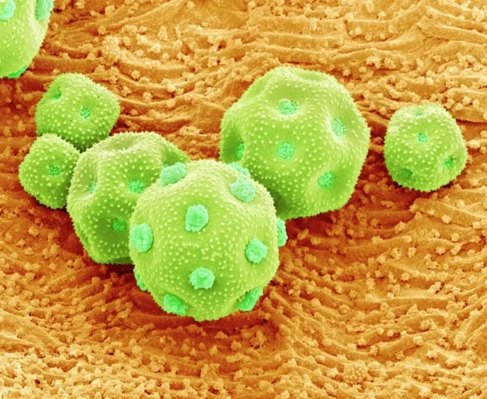 Gerahmter Druck : Grünfarnen Pollensäedlinge im SEM Gerahmter Druck : Grünfarnen Pollensäedlinge im SEM