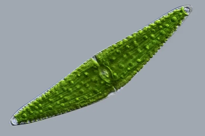 Gerahmter Druck : Klosterium desmids, Lichtmikroskopbild Gerahmter Druck : Klosterium desmids, Lichtmikroskopbild