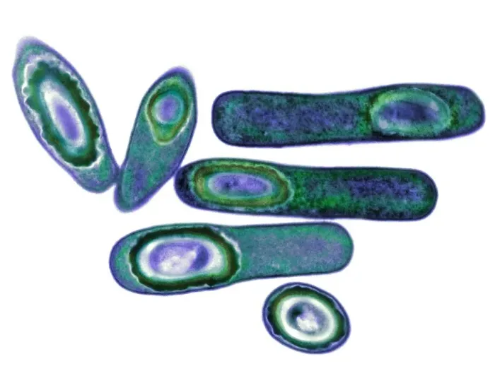 Gerahmter Druck : Clostridium difficile Bakterien, TEM Gerahmter Druck : Clostridium difficile Bakterien, TEM