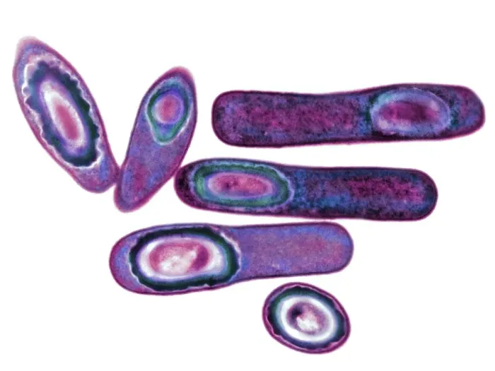 Gerahmter Druck : Clostridium difficile Bakterien, TEM