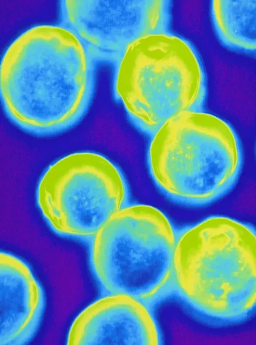 Gerahmter Druck : Kolorierte LM von Halococcus Bakterien Gerahmter Druck : Kolorierte LM von Halococcus Bakterien