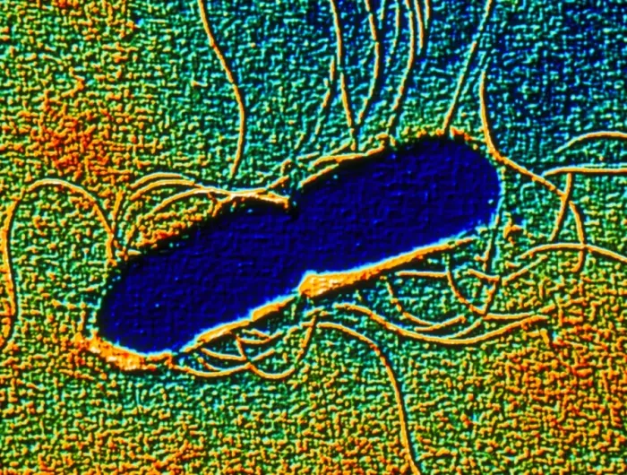 Gerahmter Druck : Farbiger SEM von Clostridium botulinum Gerahmter Druck : Farbiger SEM von Clostridium botulinum