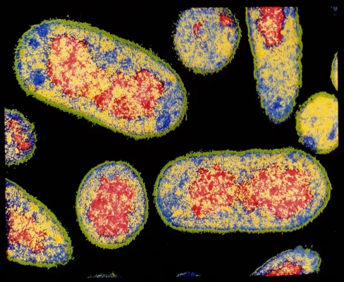Gerahmter Druck : Farbiger TEM von E. coli-Bakterium Gerahmter Druck : Farbiger TEM von E. coli-Bakterium