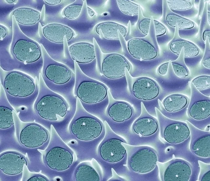 Gerahmter Druck : Diatom-Schale, SEM Gerahmter Druck : Diatom-Schale, SEM