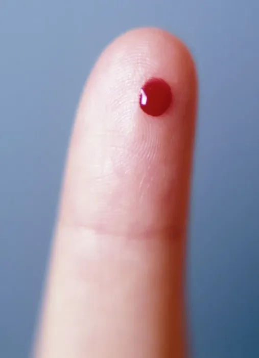 Gerahmter Druck : Tropfen Blut Gerahmter Druck : Tropfen Blut