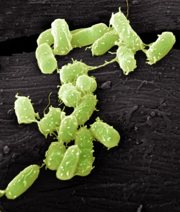 Gerahmter Druck : Escherichia coli Bakterien, SEM Gerahmter Druck : Escherichia coli Bakterien, SEM