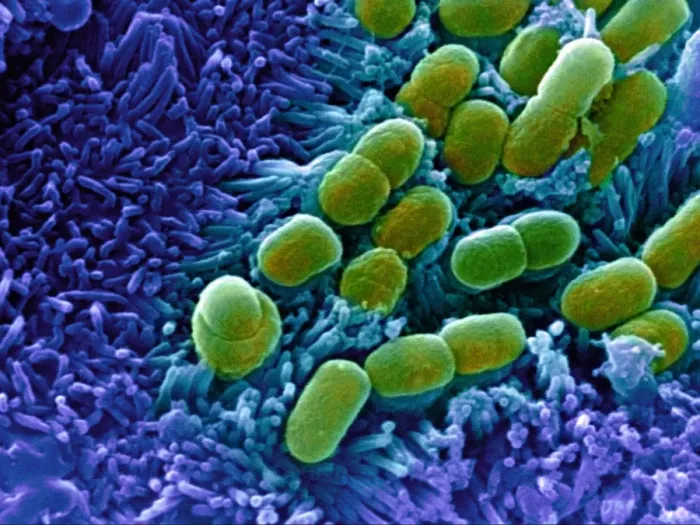 Gerahmter Druck : Escherichia coli Bakterien, SEM Gerahmter Druck : Escherichia coli Bakterien, SEM