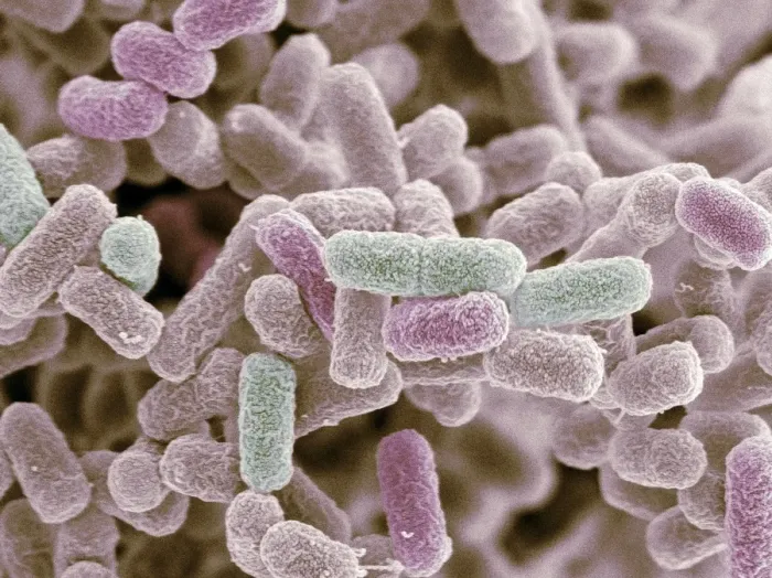 Gerahmter Druck : Escherichia coli Bakterien, SEM Gerahmter Druck : Escherichia coli Bakterien, SEM