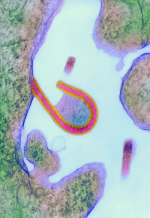 Gerahmter Druck : Ebolas Virus, TEM Gerahmter Druck : Ebolas Virus, TEM