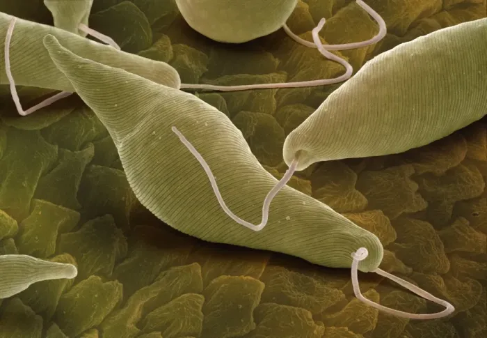 Gerahmter Druck : Euglenagracilis, SEM Gerahmter Druck : Euglenagracilis, SEM