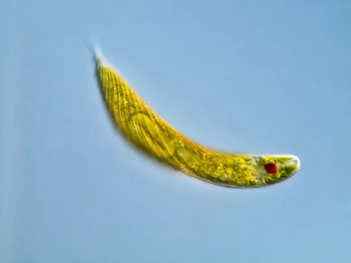 Gerahmter Druck : Euglenazyste Protozoan, Lichtmikroskop Gerahmter Druck : Euglenazyste Protozoan, Lichtmikroskop
