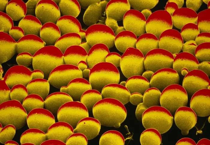 Gerahmter Druck : Falschfarbendes SEM-Bild von Hefezellen Gerahmter Druck : Falschfarbendes SEM-Bild von Hefezellen