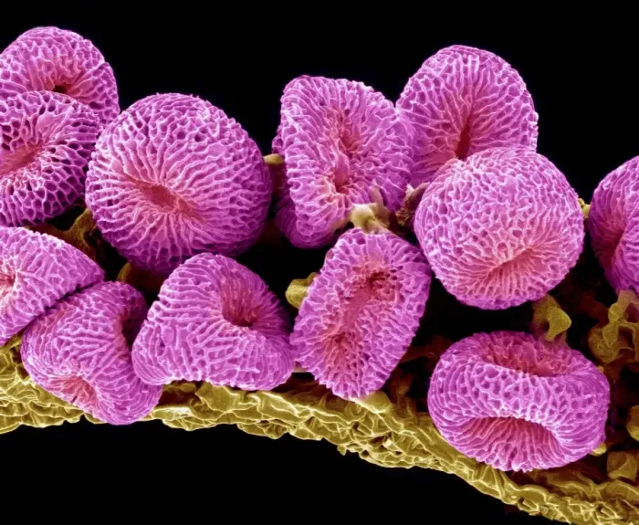 Gerahmter Druck : Geranium-Pollen, SEM Gerahmter Druck : Geranium-Pollen, SEM