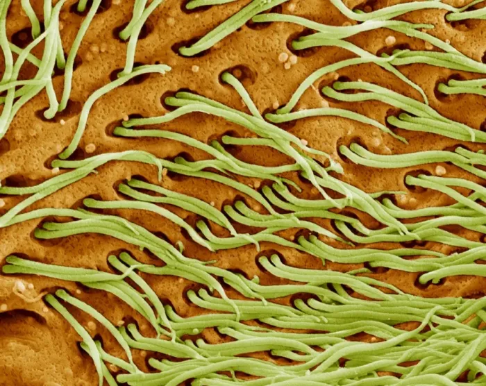 Gerahmter Druck : protozoaale Flagellen, SEM Gerahmter Druck : protozoaale Flagellen, SEM