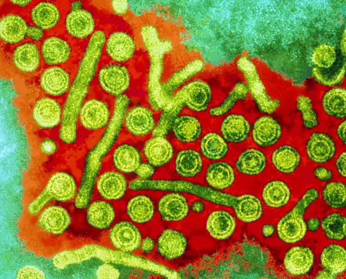 Gerahmter Druck : Hepatitis-B-Viren, TEM Gerahmter Druck : Hepatitis-B-Viren, TEM