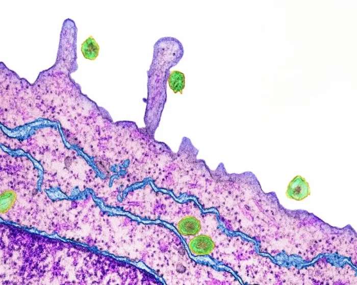 Gerahmter Druck : Cholestatitis C-Viren, TEM Gerahmter Druck : Cholestatitis C-Viren, TEM