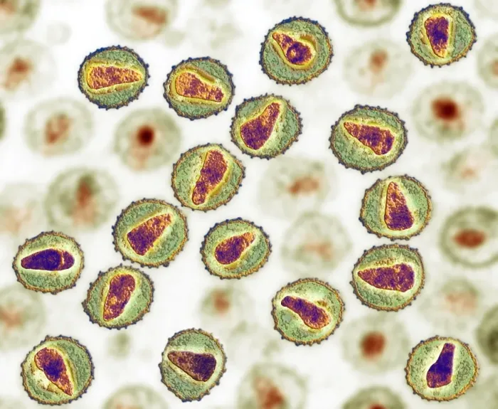 Gerahmter Druck : HIV-Partikel, TEM Gerahmter Druck : HIV-Partikel, TEM