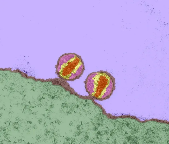 Gerahmter Druck : HIV-Viren, TEM Gerahmter Druck : HIV-Viren, TEM