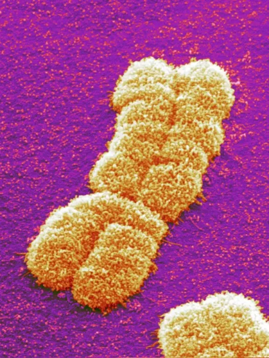 Gerahmter Druck : Menschchromosompaar, SEM Gerahmter Druck : Menschchromosompaar, SEM