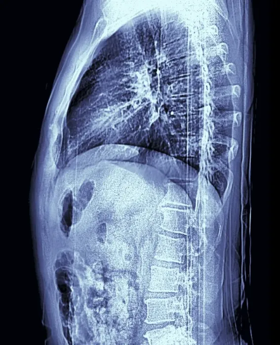 Gerahmter Druck : Menschliches Torso, MRT-Scan Gerahmter Druck : Menschliches Torso, MRT-Scan