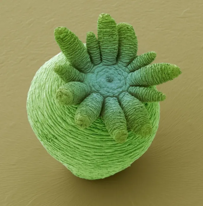Gerahmter Druck : Hydra, SEM = Hydra (Lebensform), Scanning Elektronenmikroskop Gerahmter Druck : Hydra, SEM = Hydra (Lebensform), Scanning Elektronenmikroskop