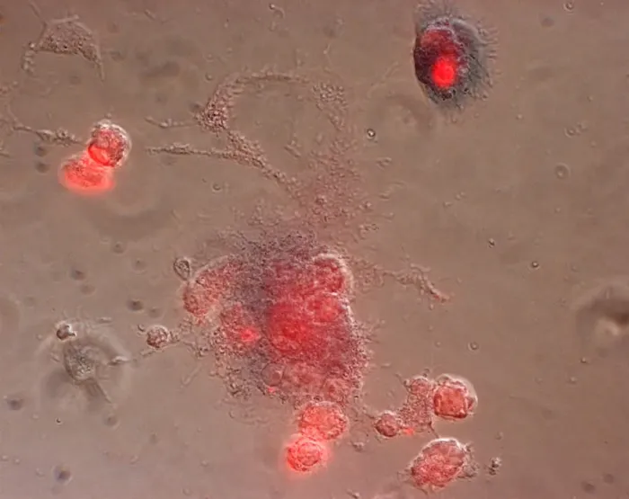 Gerahmter Druck : Immunantwort Gerahmter Druck : Immunantwort