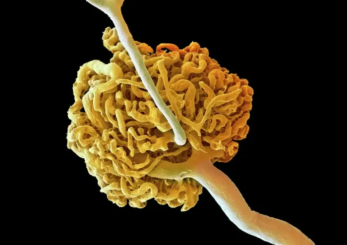 Gerahmter Druck : Nierenglomerulus, SEM Gerahmter Druck : Nierenglomerulus, SEM