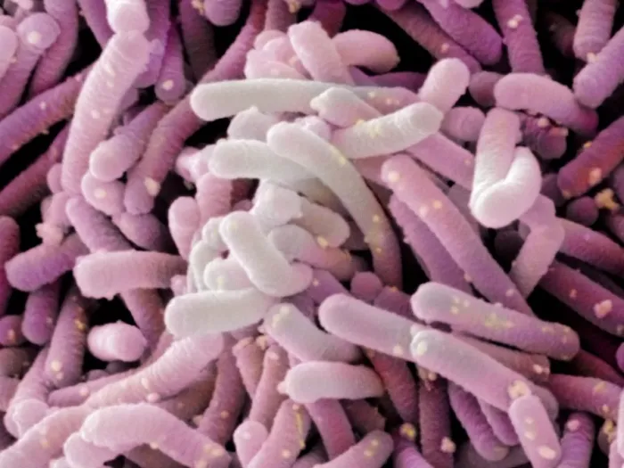 Gerahmter Druck : Lactobacillus casei shirota (SEM) Gerahmter Druck : Lactobacillus casei shirota (SEM)