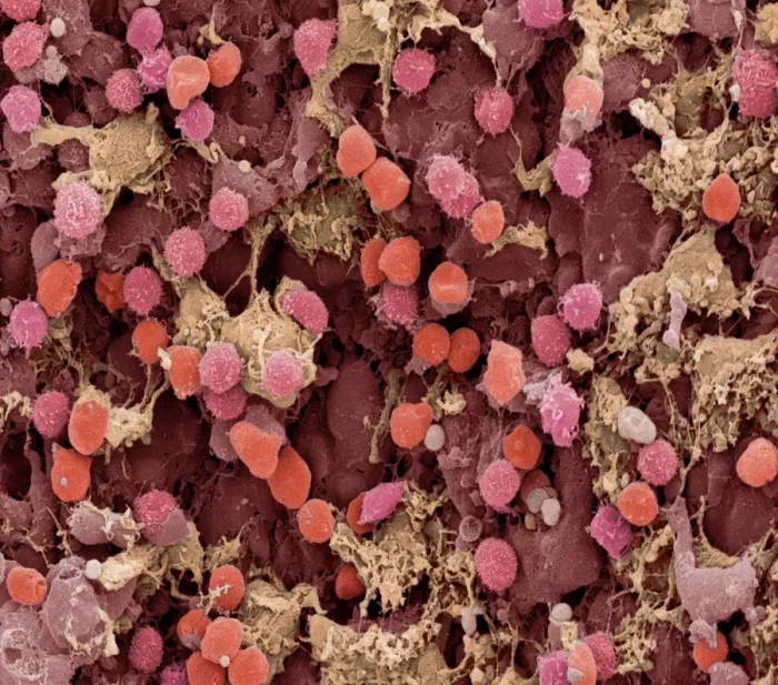 Gerahmter Druck : Lymphknoten, SEM Gerahmter Druck : Lymphknoten, SEM
