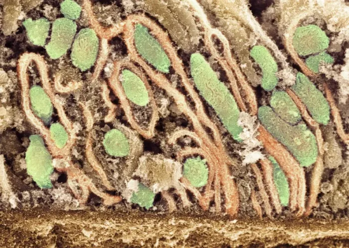 Gerahmter Druck : Mitochondrien, SEM Gerahmter Druck : Mitochondrien, SEM