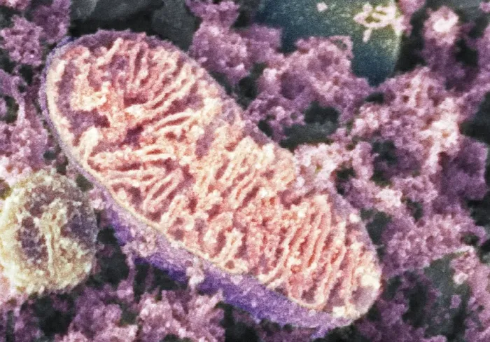Gerahmter Druck : Mitochondrium, SEM Gerahmter Druck : Mitochondrium, SEM