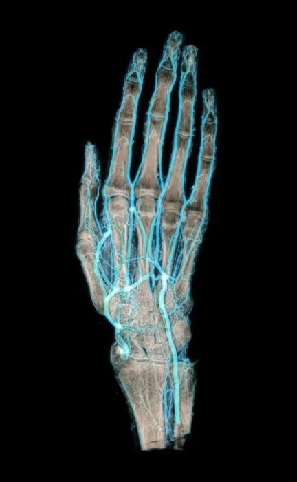 Gerahmter Druck : Vermummelte Hand Gerahmter Druck : Vermummelte Hand