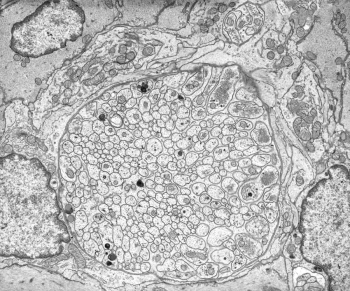Gerahmter Druck : Mesenterisches Nervenplexus, TEM Gerahmter Druck : Mesenterisches Nervenplexus, TEM