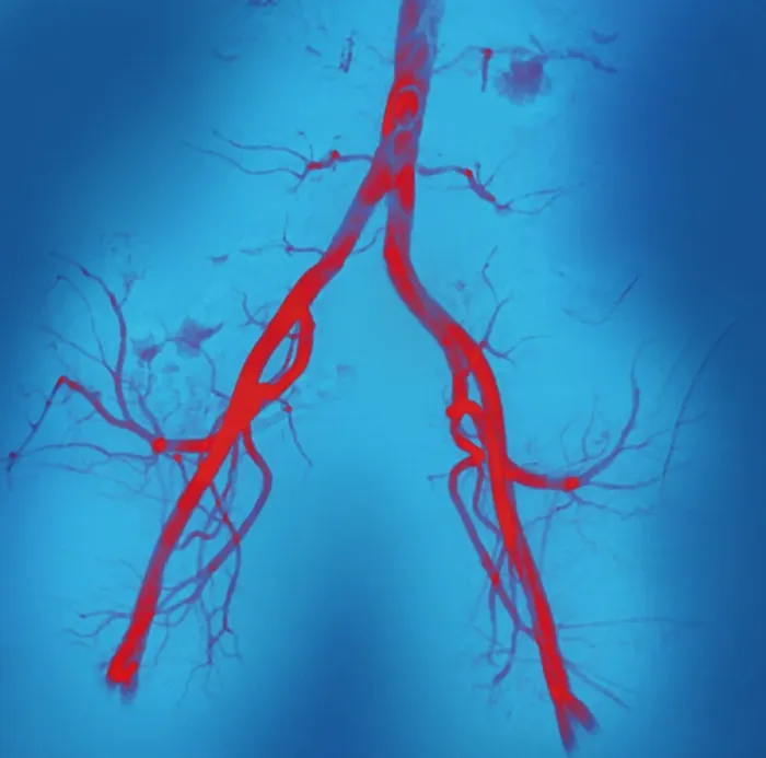Gerahmter Druck : Normale Baucharterien, Angiogramm. Gerahmter Druck : Normale Baucharterien, Angiogramm.