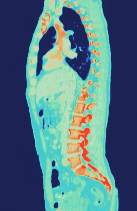 Gerahmter Druck : Normales Torso, MRT-Scan Gerahmter Druck : Normales Torso, MRT-Scan