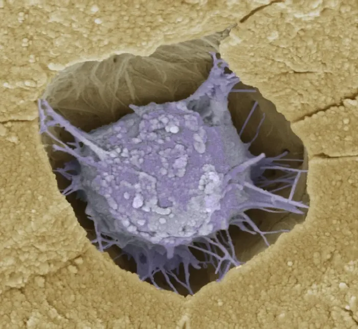 Gerahmter Druck : Knochenblutzelle Osteoblast, SEM Gerahmter Druck : Knochenblutzelle Osteoblast, SEM