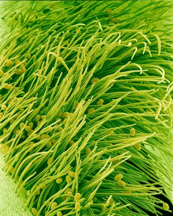 Gerahmter Druck : Bohnenblumenstiel-Spalt, SEM Gerahmter Druck : Bohnenblumenstiel-Spalt, SEM