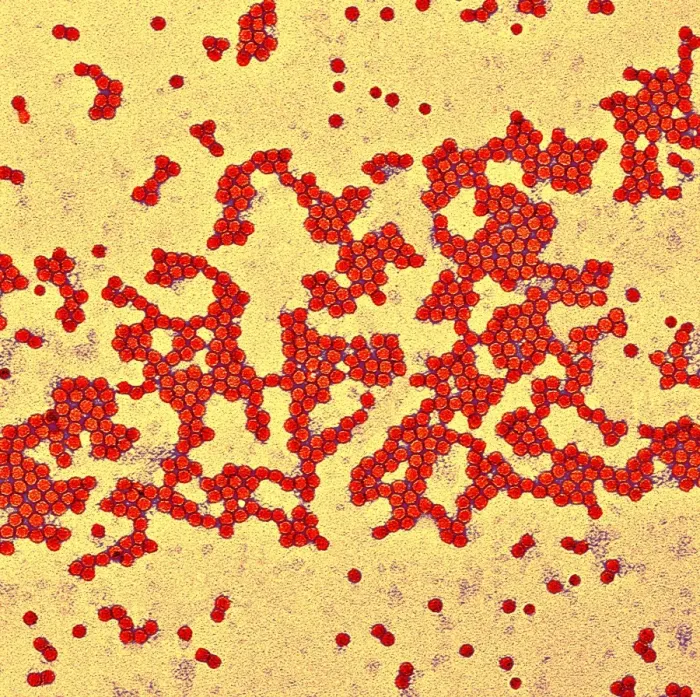 Gerahmter Druck : Polio-Virenpartikel, TEM Gerahmter Druck : Polio-Virenpartikel, TEM